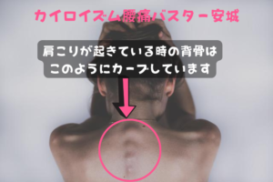 肩こりの背骨の歪み