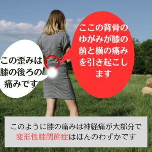 膝の痛みの原因を図を用いて説明しています