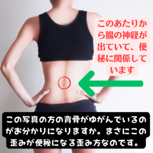 便秘の骨格