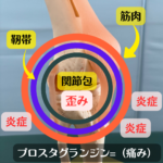 関節痛のイメージ