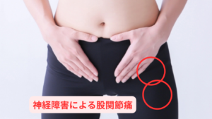 神経障害